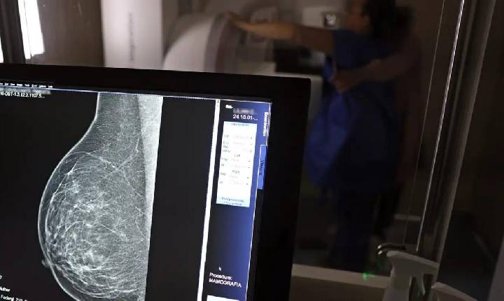 Cobertura de mamografia digital será obrigatória para todas as idades pelos planos de saúde