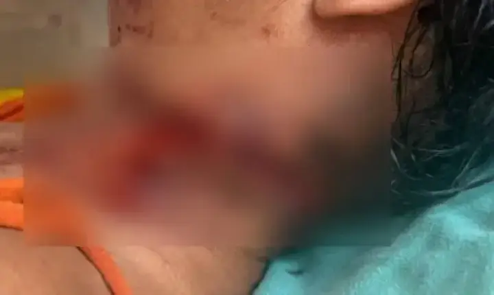 Mulher é socorrida com ferimento no pescoço e Polícia Civil investiga o caso em São Francisco do Guaporé