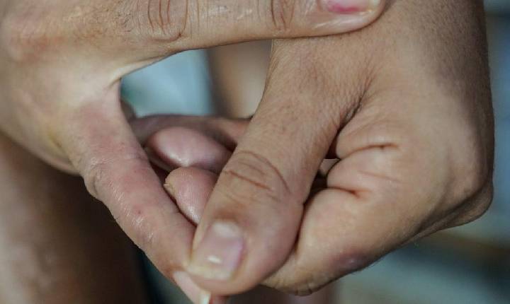 Saiba como tratar a dermatite atópica e seus impactos na pele, sono e autoestima