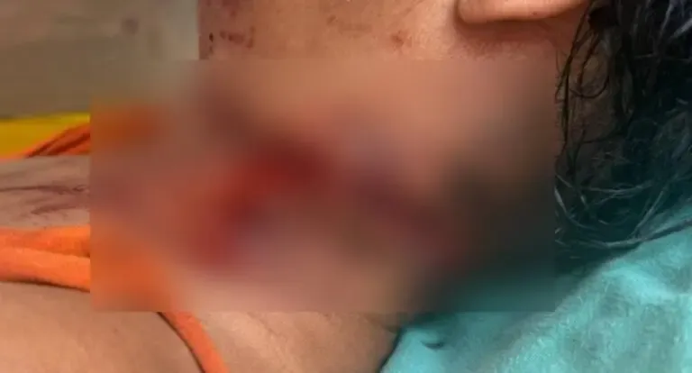Mulher é socorrida com ferimento no pescoço e Polícia Civil investiga o caso em São Francisco do Guaporé