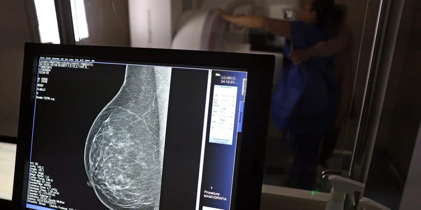 Cobertura de mamografia digital será obrigatória para todas as idades pelos planos de saúde
