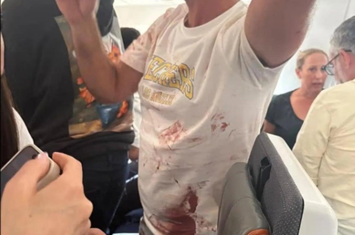 Queda drástica de avião da Flydubai acompanha episódio de violência na cabine