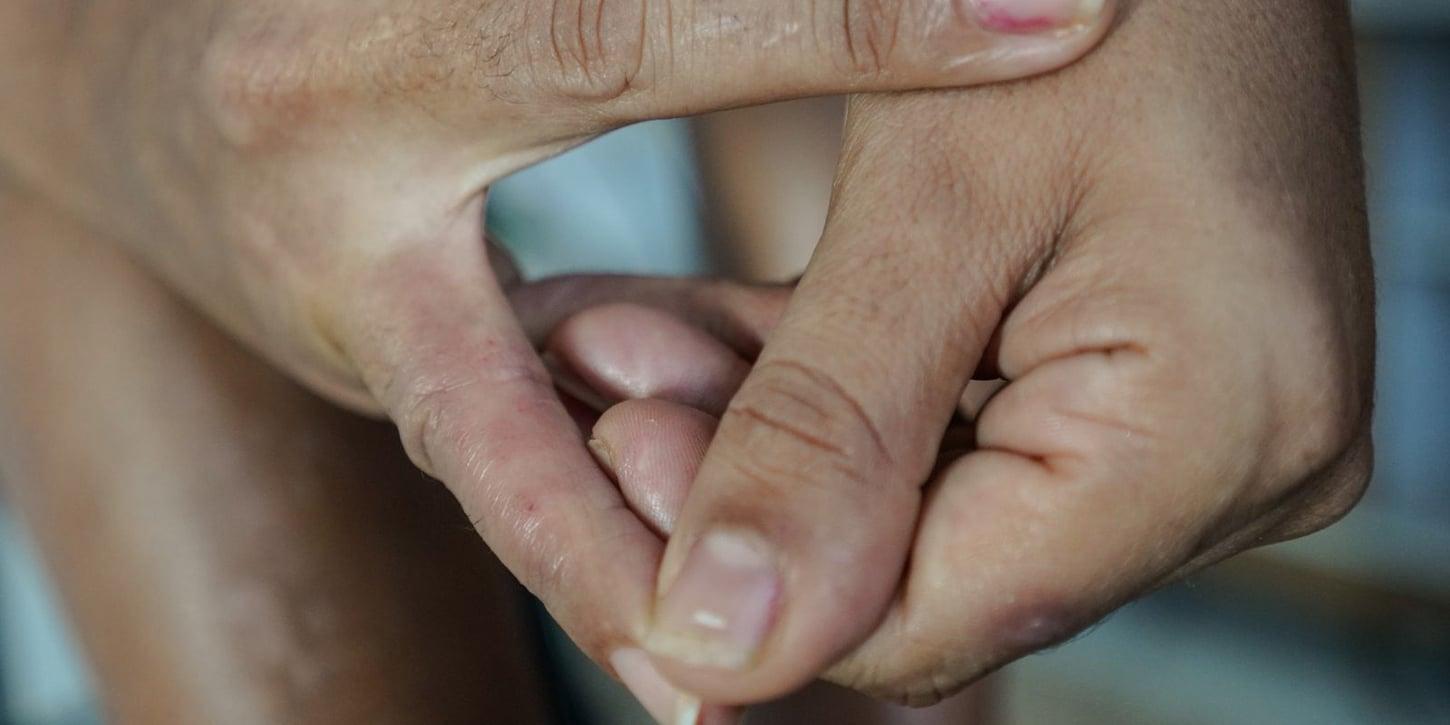 Saiba como tratar a dermatite atópica e seus impactos na pele, sono e autoestima
